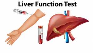 Liver Function Testing